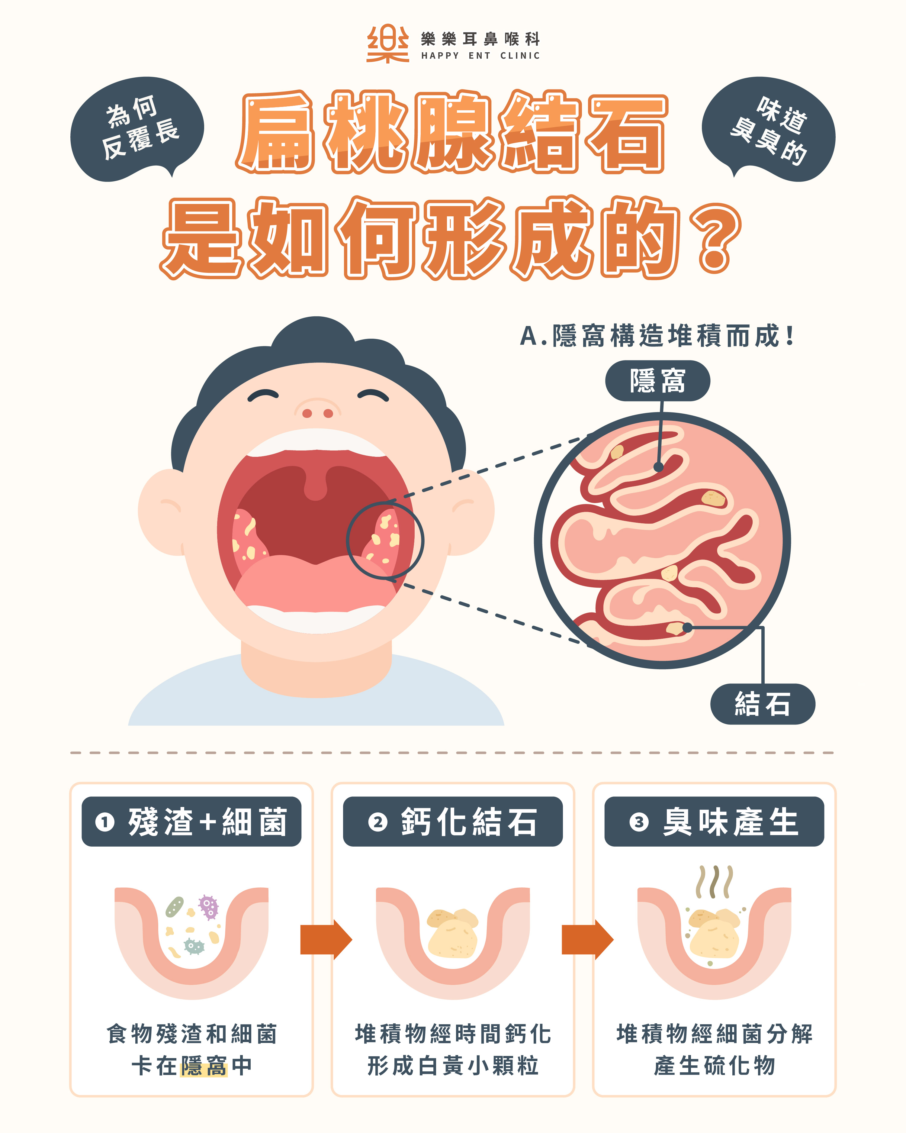 樂樂耳鼻喉科衛教示意圖