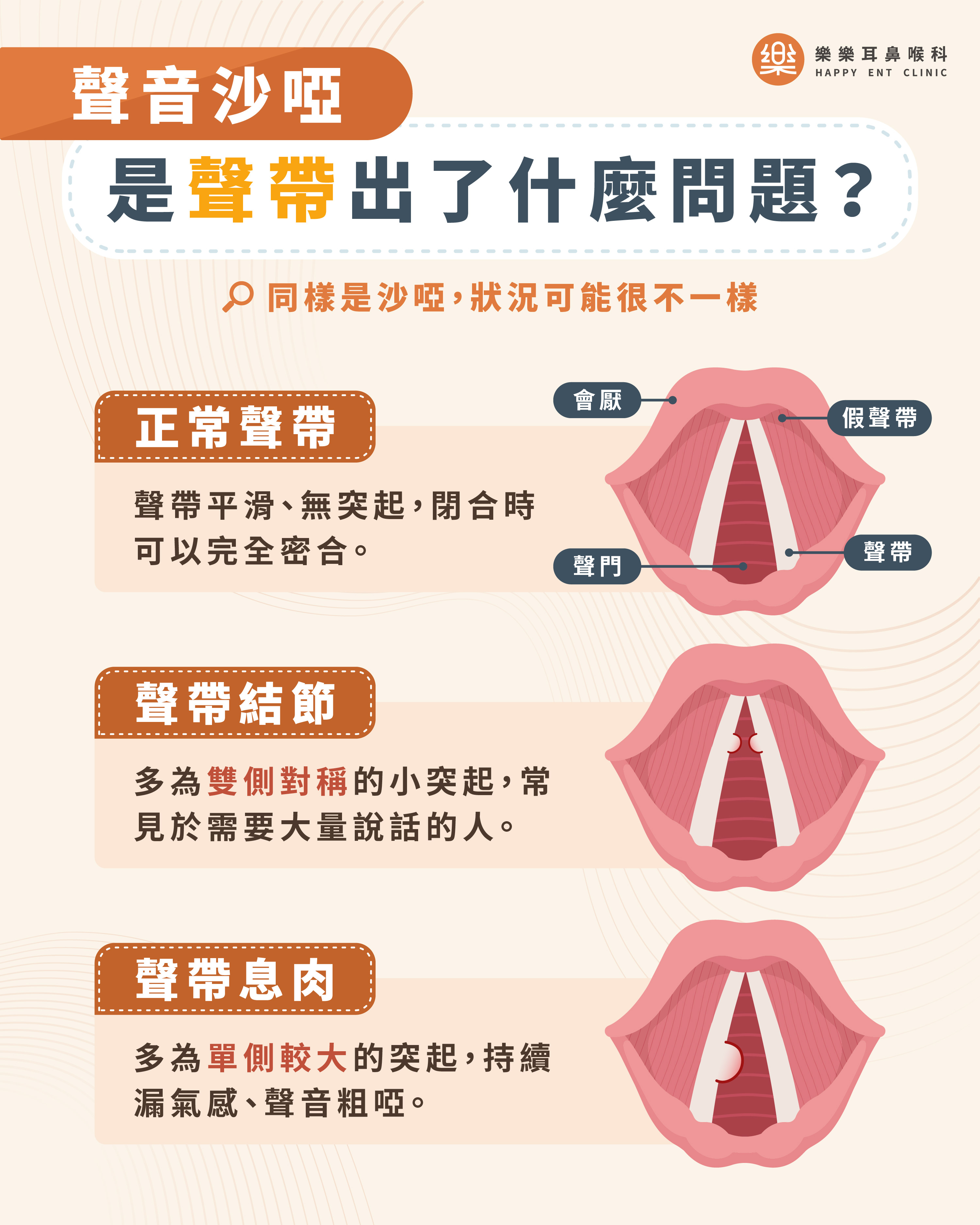 樂樂耳鼻喉科衛教示意圖