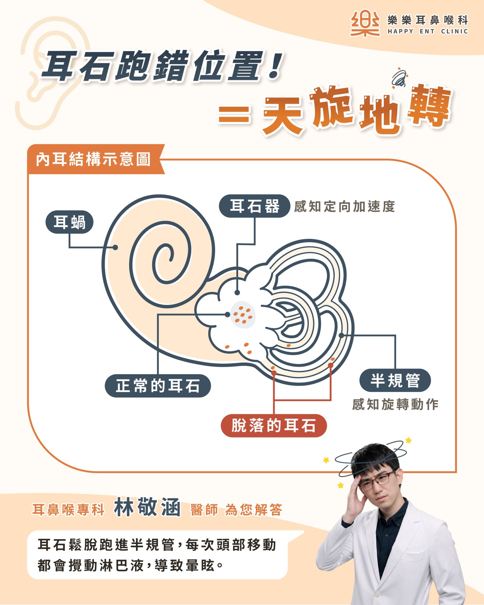 耳石脫落是內耳微小結晶跑進半規管造成姿勢性眩暈