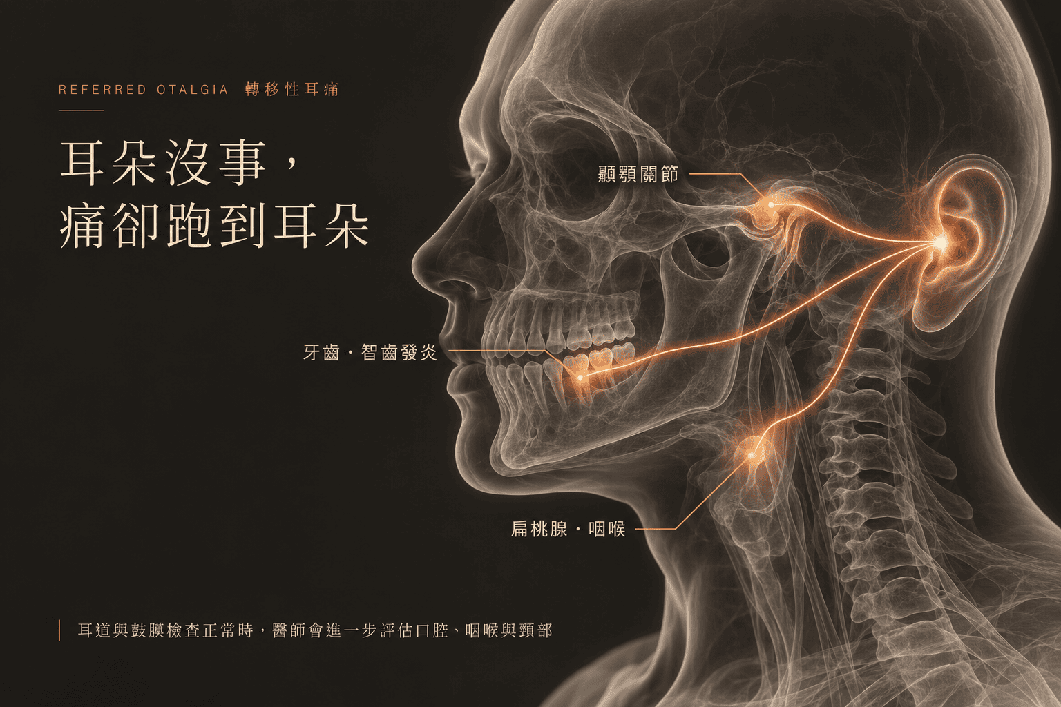 耳朵痛原因示意圖，耳朵沒事，痛卻跑到耳朵，樂樂耳鼻喉科診所