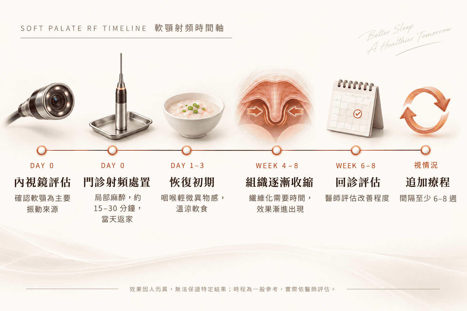 軟顎位置解剖示意圖，說明打呼振動來源，樂樂耳鼻喉科診所
