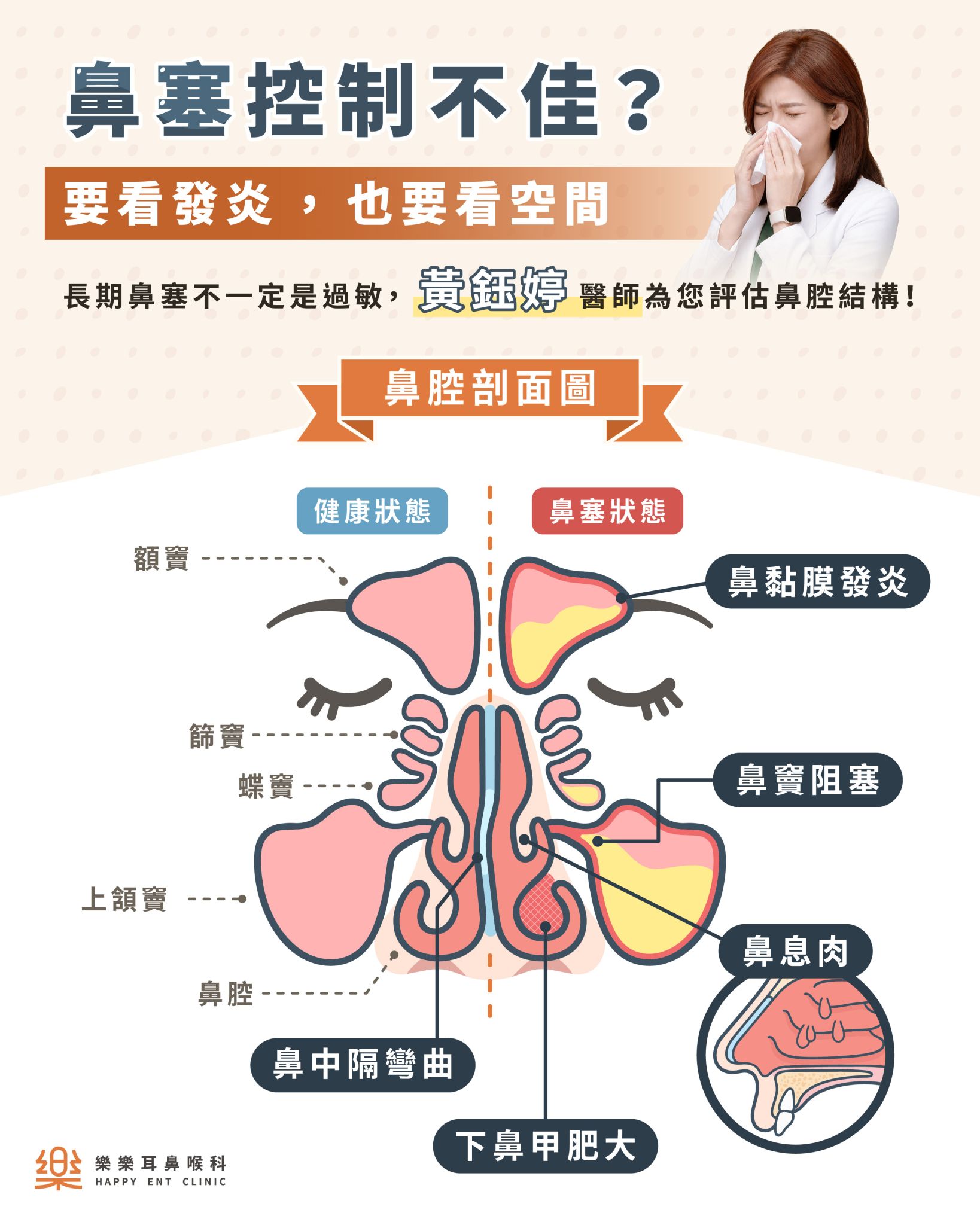 鼻過敏就醫評估示意